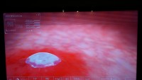Samsung UE40D5000 - Black Horizontal Bars/Stripes at Top of Screen Issue: Matrix or Repairable?